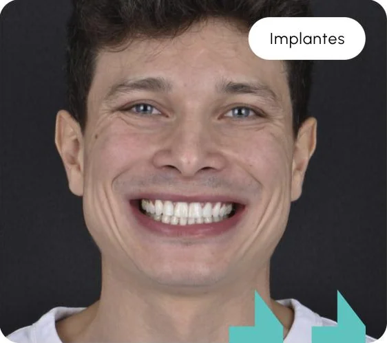 Lorem Ipsum