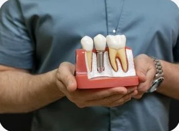 Implantes dentales